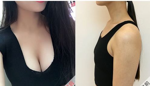 中國醫(yī)學科學院整形外科醫(yī)院李發(fā)成醫(yī)生的項目特長內容是什么？詳細資料及就診信息介紹