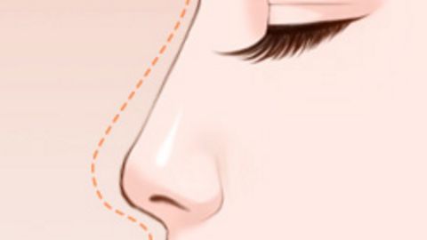 國(guó)內(nèi)整容醫(yī)院哪家值得信賴？面部吸脂推薦選這幾家！公立和私立醫(yī)美機(jī)構(gòu)實(shí)力強(qiáng)勁！