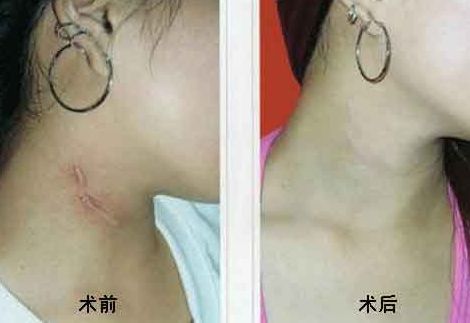 重慶乳房整形六大權(quán)威醫(yī)生盤點(diǎn)，高素質(zhì)專家排行曝光