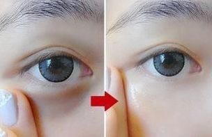 唇部手術(shù)后如何快速恢復(fù)？必須掌握的護理要點！