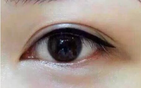 2023年四川明星雙眼皮專家全球發(fā)布丨郭祥文、郭波、肖海濤top5醫(yī)師介紹