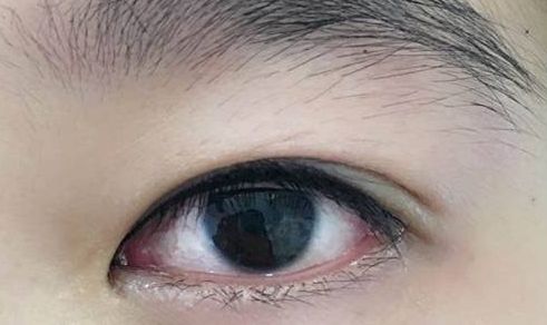 上海整形界最受歡迎的吸脂專家推薦，李耐國、曹衛(wèi)剛、李發(fā)成等醫(yī)生備受贊譽！附真實案例供參考