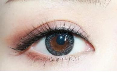 石家莊專家何靜雙眼皮技術(shù)如何？真人案例揭秘雙眼皮效果