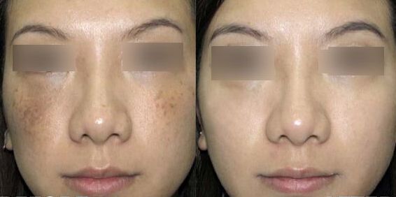 揭秘南京鼻王身份！專家盛贊前五強醫(yī)生，引人入勝！