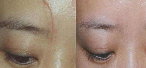 北京隆鼻哪里做得好？美容大夫們看好的三家醫(yī)院參考