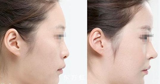 蘇州無(wú)線頻率融脂?？漆t(yī)生排名前十這幾位醫(yī)術(shù)聲譽(yù)超卓的醫(yī)生是您的不二之選