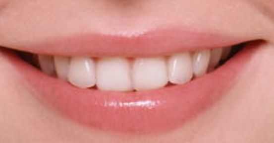 鄭州假體隆胸權威醫(yī)生推薦名單，值得信賴的選擇