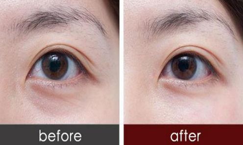 廣州荔灣人民醫(yī)院與中家醫(yī)整容醫(yī)院：醫(yī)療實力PK，看誰更勝一籌