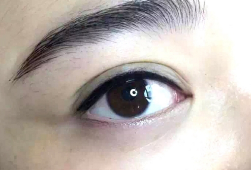 深圳龍翔醫(yī)院醫(yī)療整形美容科效果如何？醫(yī)生是否專業(yè)可信？