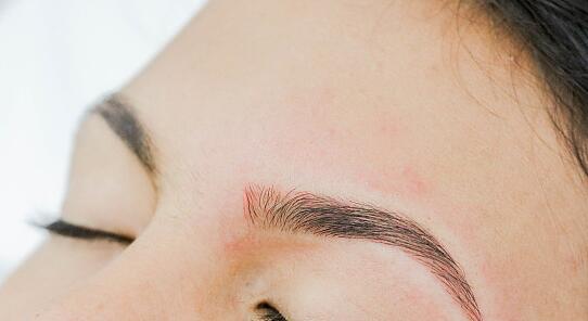 哈爾濱雙燕醫(yī)療美容門診部的醫(yī)生技術(shù)水平如何？他們的服務(wù)值得信賴嗎？是否有患者對他們治療效果表示滿意？