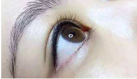 長(zhǎng)沙哪位醫(yī)生在雙眼皮修復(fù)技術(shù)上口碑好找排名靠前的？