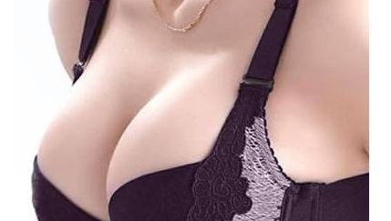 北京王光輝雙眼皮術(shù)后半年感受大揭秘！