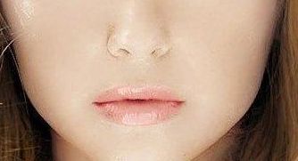 王維九院的雙眼皮修復(fù)技術(shù)值得信賴嗎？專家實(shí)力與成功案例給出參考