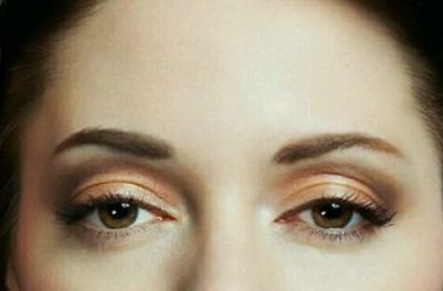 重慶雙眼皮手術(shù)那個醫(yī)生更勝一籌？對比專家們的審美意見。