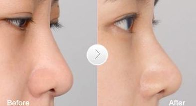 高效祛疤地，推薦的整形醫(yī)院在廣州！更有名口碑榜單盤點