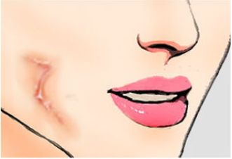 上海哪家醫(yī)美整形醫(yī)院口碑好？推薦排行：華美、時光、美萊等