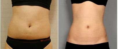 錦州美容整形科專家介紹及收費明細(xì)表完善！