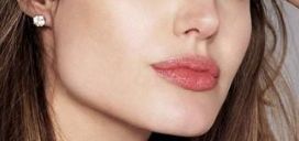 鄭州趙絳波卓越案例揭示——手術成功后煥然一新！