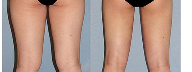 溧陽(yáng)市眼科專家就診推薦，醫(yī)生名單及治療費(fèi)用一覽