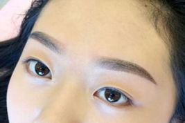 如何優(yōu)雅地擁有雙眼皮？了解專家經驗與最新案例！