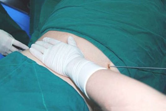 教您識別義烏隆鼻效果好的醫(yī)院！頂級機構推薦，芙洛拉、連天美站在年度精選之列！