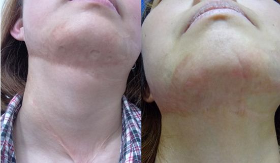 上海九院下頜角整形領(lǐng)域的知名醫(yī)師推薦！名醫(yī)師百人精選！