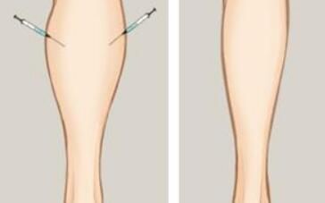 鄭州天后醫(yī)療美容醫(yī)院有哪些病例分享？