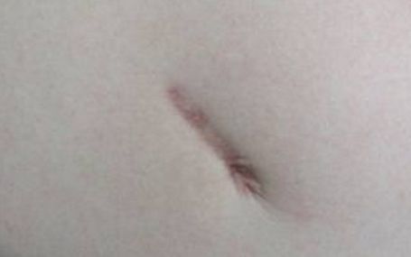 武漢頂尖眼袋整形醫(yī)生綜合評比當?shù)刂t(yī)師資料公開揭曉