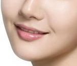 上海九院周佳雙眼皮整形效果與成功案例展示