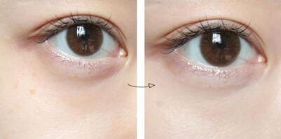 滄州隆鼻有哪些醫(yī)院可以做？如何選擇適合自己的醫(yī)院