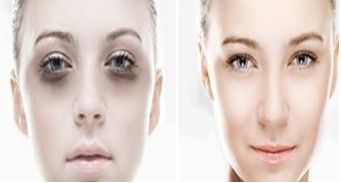 上海第九人民醫(yī)院正頜正畸：專家團(tuán)隊(duì)幫您獲得完美笑容