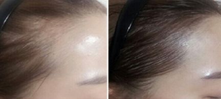 鄭州芳藝醫(yī)療整形醫(yī)院有沒有特色項目？如何一鍵獲取？