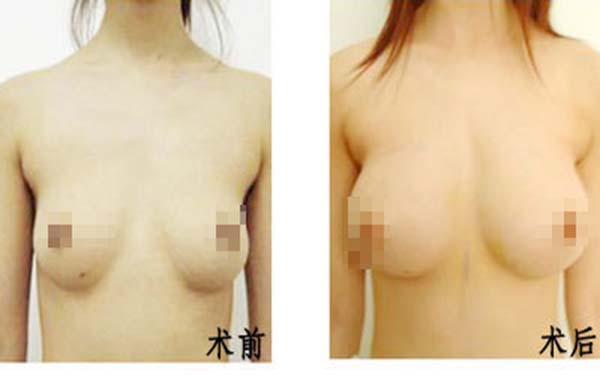 遂寧伊莎貝拉醫(yī)學(xué)美容門(mén)診部醫(yī)生是否值得信賴(lài)？他們的專(zhuān)業(yè)素質(zhì)如何？