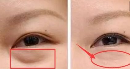 揭秘昆明雙眼皮明星醫(yī)生！驚喜榜單出爐，內(nèi)有杜海寬、王靜等大咖名醫(yī)！