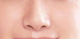 袁斯明醫(yī)生手術(shù)預(yù)約時效如何？祛疤效果有多好？解讀金陵醫(yī)院專家信息！