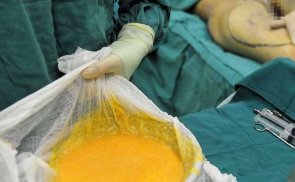 看準(zhǔn)這些專(zhuān)科醫(yī)院，清楚雙眼皮手術(shù)，哪家最靠譜？