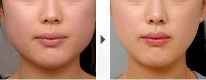 杭州美容醫(yī)院搶眼榜單，《格萊美醫(yī)療美容》與《連天美》齊名