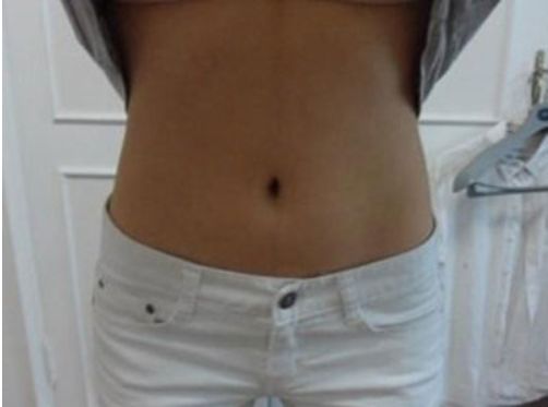 國(guó)內(nèi)知名雙眼皮大師推薦名單，附蘇薇潔、魏志香、王世勇等醫(yī)師！