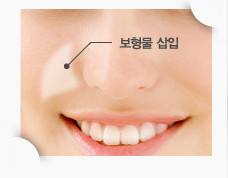 哈爾濱伊尚顏整形醫(yī)院項目如何？醫(yī)生技術(shù)是否可靠？