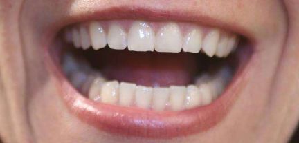 申霄與銀山：雙眼皮醫(yī)生大PK！誰更出彩？