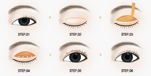 北京301整形科醫(yī)生評價和患者反饋