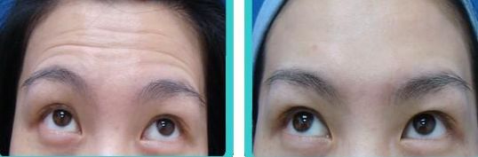 ?？谘鄹C凹陷修復(fù)醫(yī)療機(jī)構(gòu)綜合排名，技術(shù)引領(lǐng)修復(fù)效果競賽！