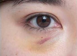 上海市那家醫(yī)療機構(gòu)的鼻整形效果較好呢？