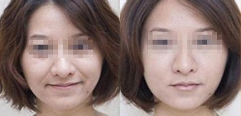 成都有哪些專業(yè)的雙眼皮整形醫(yī)生值得推薦？