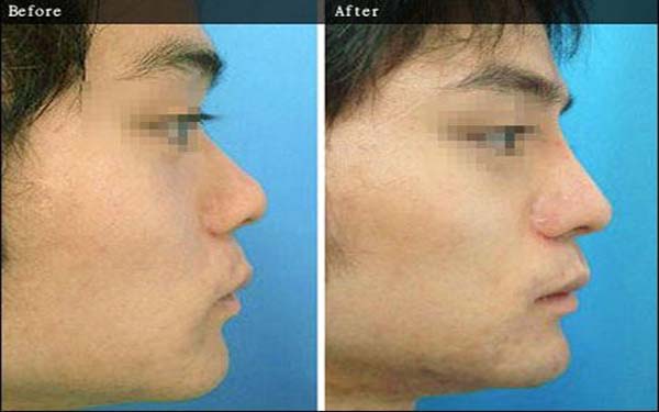 重慶軍科整形醫(yī)院是正規(guī)的嗎？吸脂怎么樣？醫(yī)生口碑評價揭曉了，真的靠譜嗎？能否滿足需求？