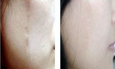 合肥專(zhuān)業(yè)磨骨手術(shù)醫(yī)院：醫(yī)術(shù)精湛，信譽(yù)有保障！