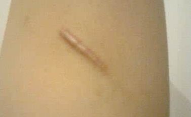 上海顧清整形哪家醫(yī)院好？看看口碑評價和隆鼻案例