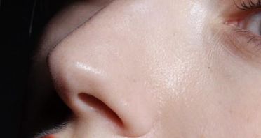 廣州植發(fā)領(lǐng)先的醫(yī)院推薦【技術(shù)認(rèn)證方面有哪些】