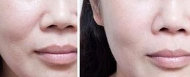 南通割雙眼皮醫(yī)生排行前八名名單公布！五星推薦供參考