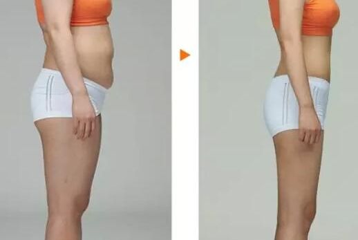 上海下頜角整形領先醫(yī)院揭曉！這三家醫(yī)院有華美、美聯(lián)臣與伊萊美！